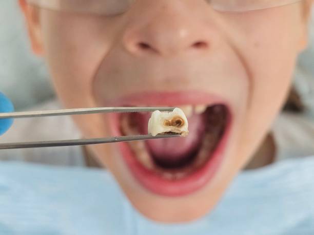 Best Weekend Emergency Dentist in Cameron Park, TX