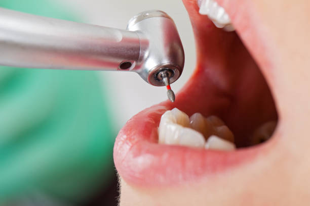 Best Emergency Orthodontic Repairs in Cameron Park, TX